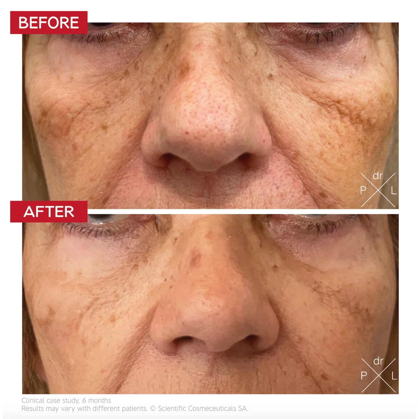 Dr. LEVY Switzerland Pigment Control Drops