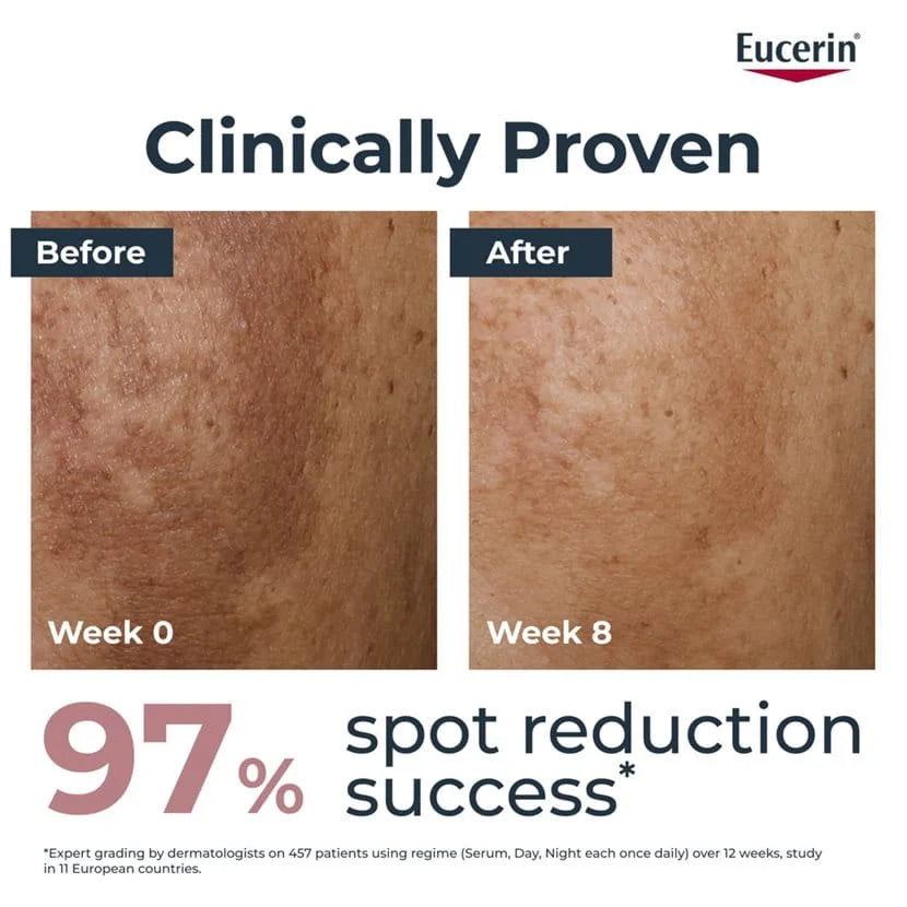 Eucerin Anti-Pigment Day Cream SPF 30