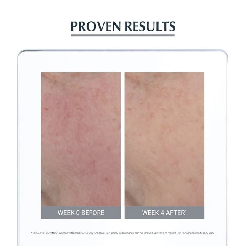 Eucerin AntiRedness Concealing Day Cream SPF 25 (Tinted)