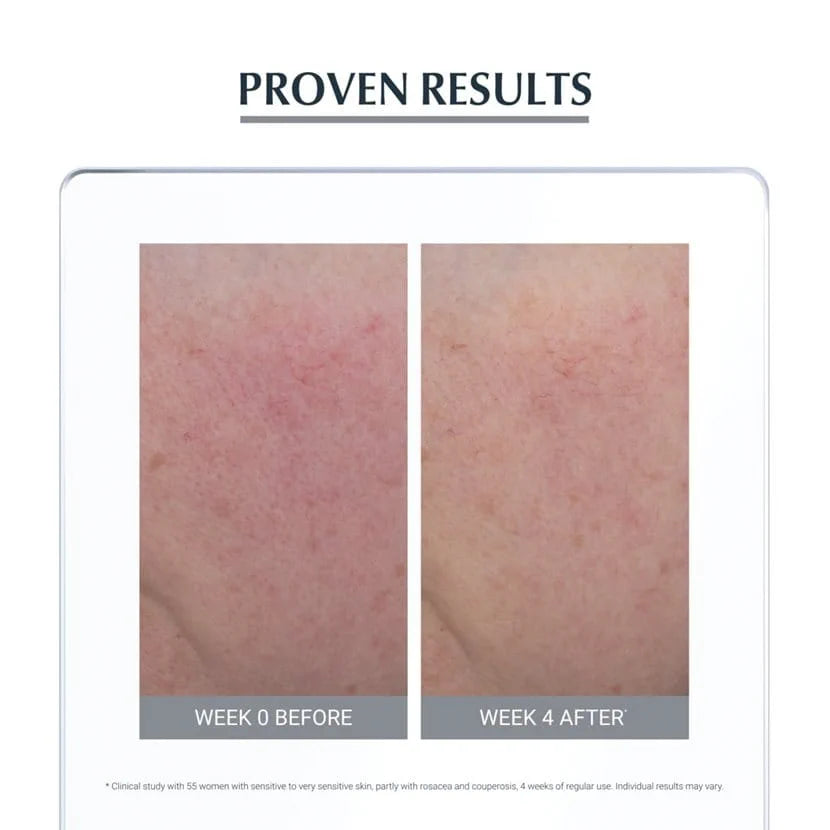 Eucerin AntiRedness Soothing Care