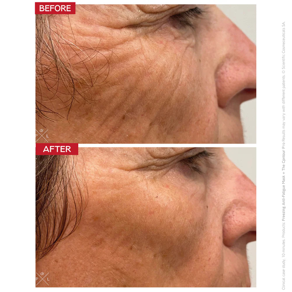 Dr. LEVY Switzerland The Contour Pro